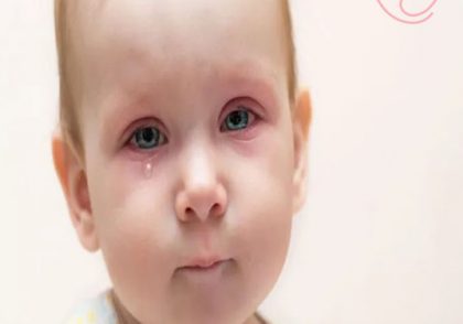 عفونت چشم نوزاد