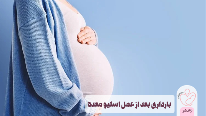 بارداری بعد از عمل اسلیو معده