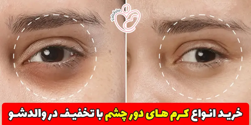 چگونه بهترین کرم دور چشم را انتخاب کنیم