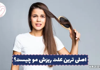 علت ریزش مو