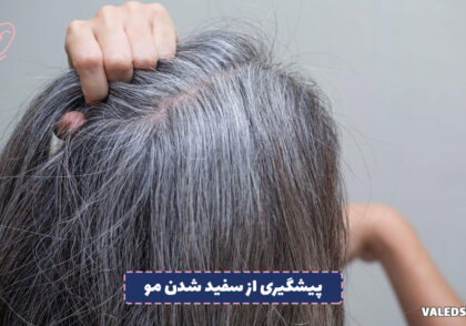 روش های پیشگیری از سفید شدن مو