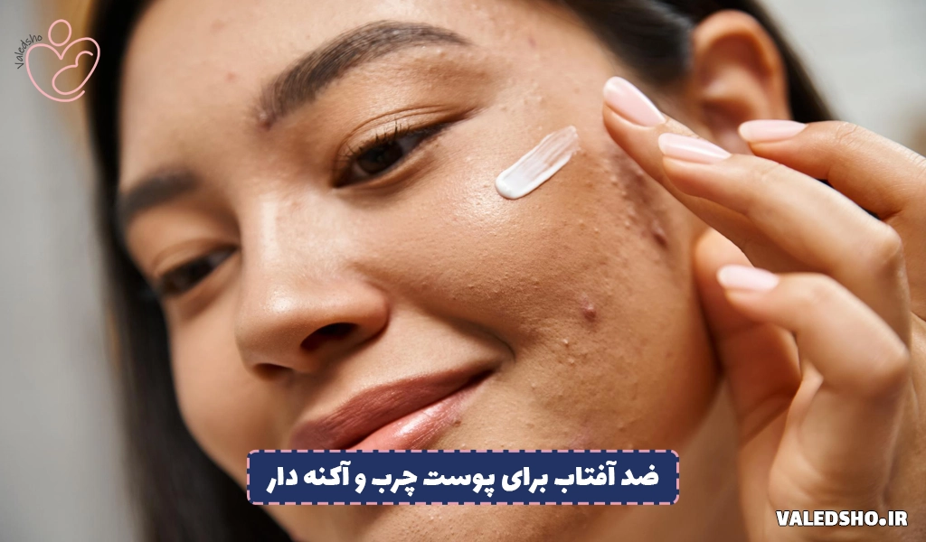ویژگی ضد آفتاب برای پوست چرب و آکنه دار 1 ویژگی ضد آفتاب برای پوست چرب و آکنه دار