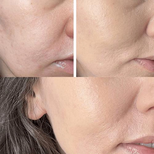 کوشن تیر تیر مدل Mask Fit