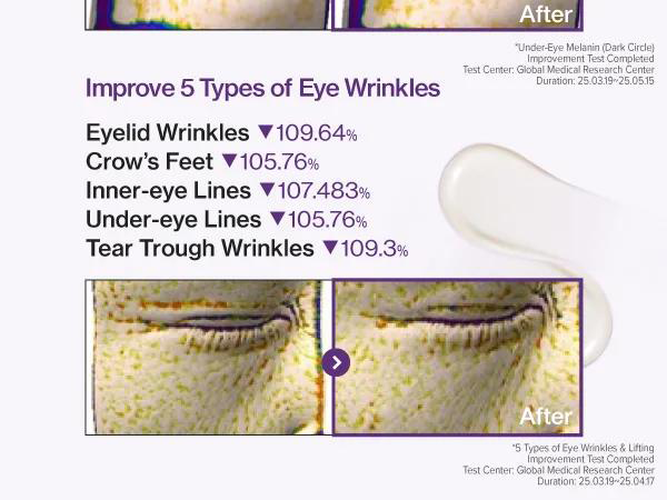 کرم دور چشم نامبوزین شماره 9 حاوی NAD+ و رتینول 3 کرم دور چشم نامبوزین شماره 9