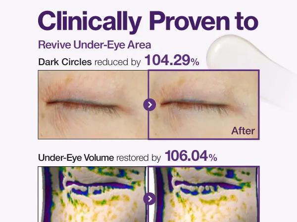 کرم دور چشم نامبوزین شماره 9 حاوی NAD+ و رتینول 2 دورچشم NAD+ و رتینول نامبوزین