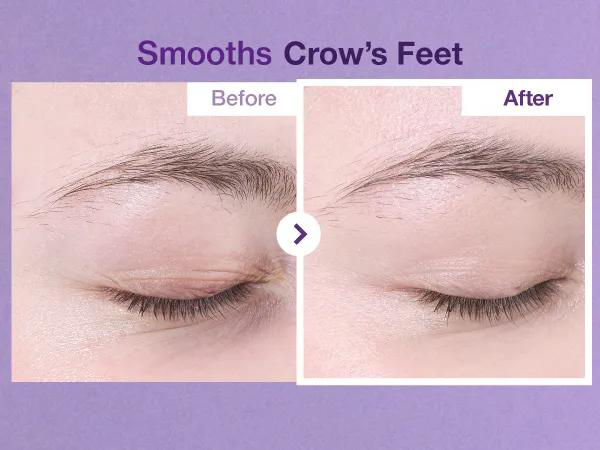 کرم دور چشم نامبوزین شماره 9 حاوی NAD+ و رتینول 1 کرم دور چشم Numbuzin No.9 NAD+ Retinol