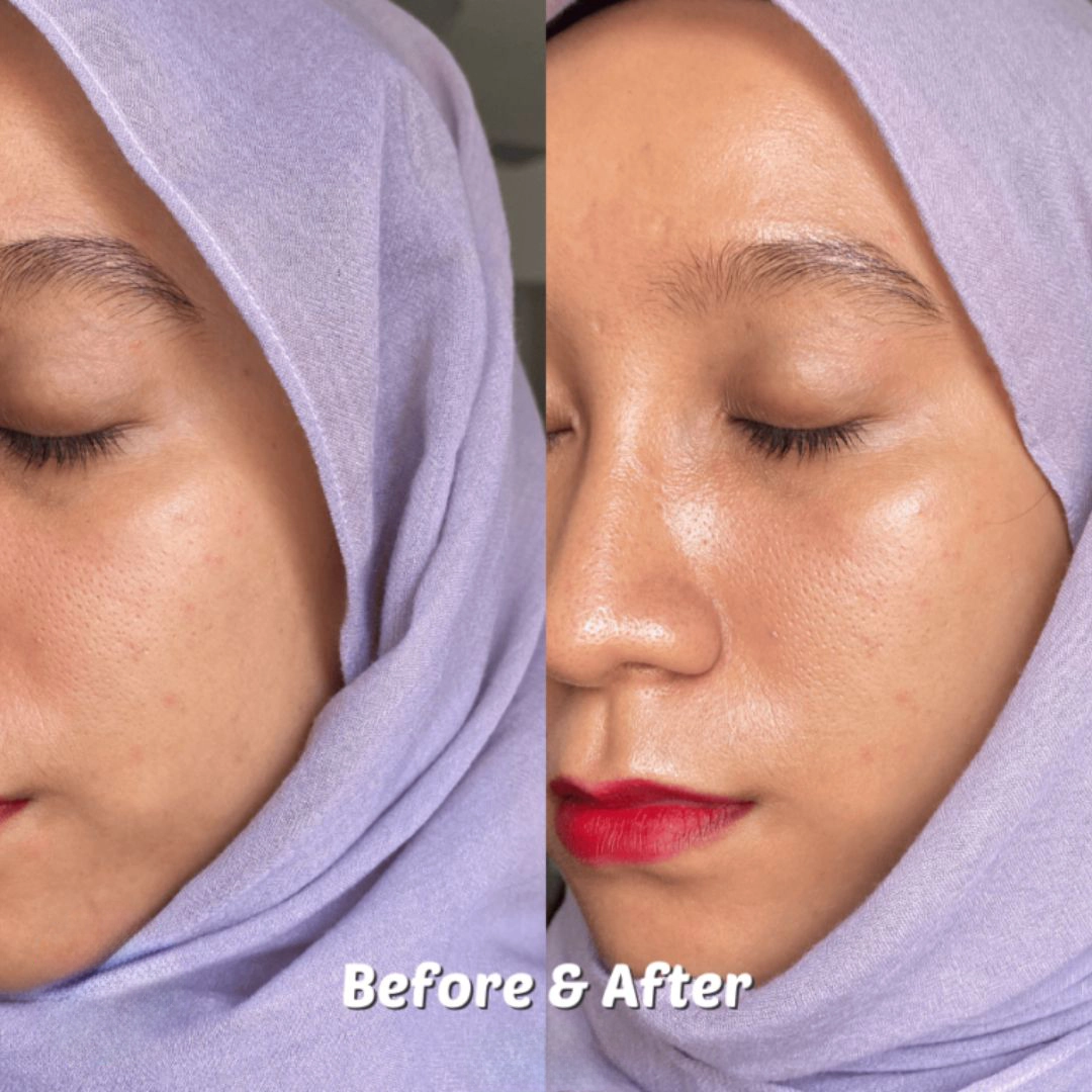 ژل ضدآفتاب آبرسان ایزنتری اصل 2 ضدآفتاب و مرطوب کننده فیزیکی حاوی هیالورونیک اسید برند ایزنتری