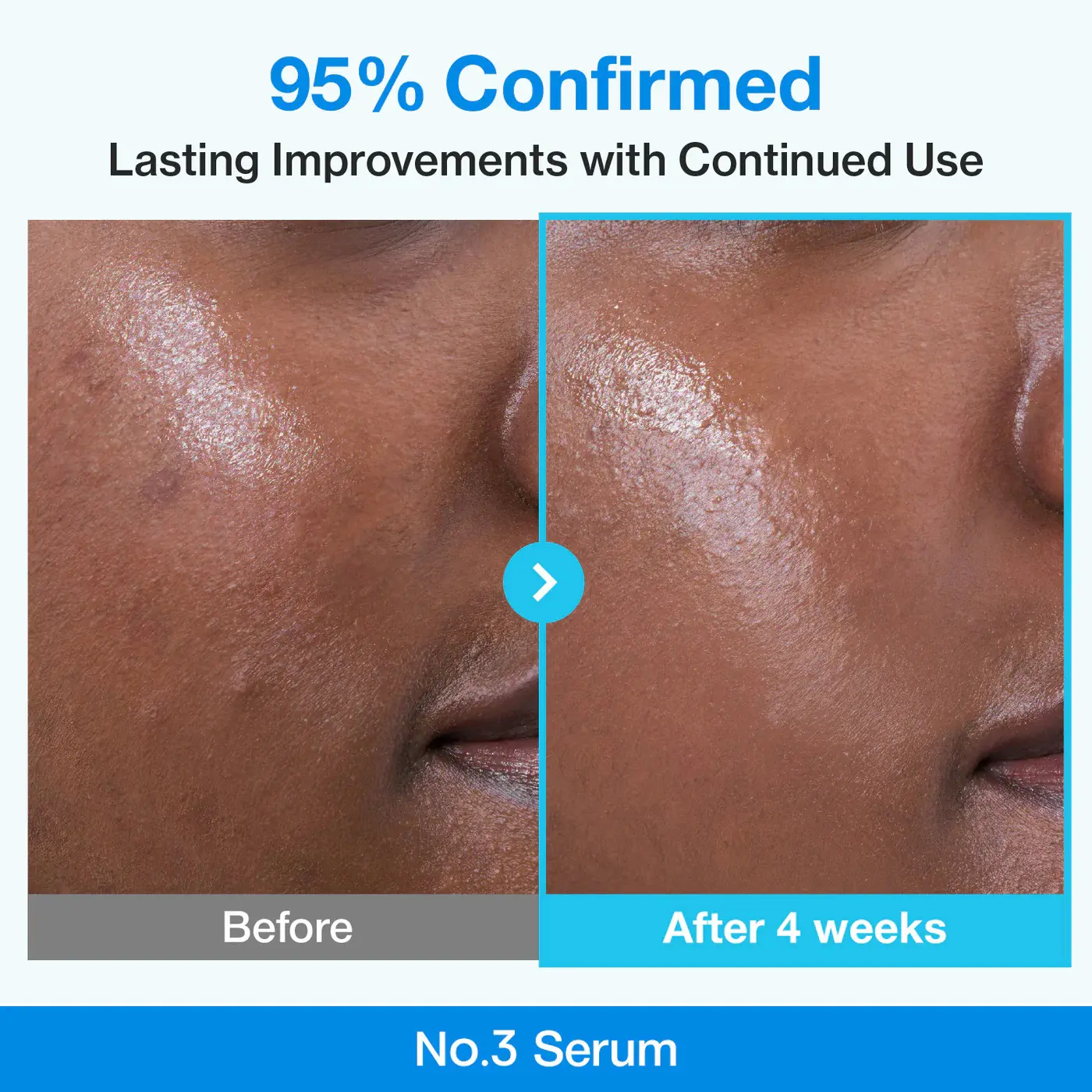 سرم رفع کننده منافذ پوست نامبوزین مدل BLUE BIO-RETINOL PORE REFINING